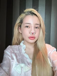 Ngân 98's Beauty Evolution: A Closer Look at Her 12 Rhinoplasty Procedures - image 6