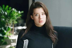 The Enigmatic Beauty of Heterochromia: Celebrating a Rare Aesthetic at Age 30 - image 6