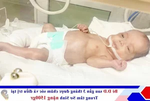 Medical Miracle: Saving a Premature Baby Born at 25 Weeks - image 2