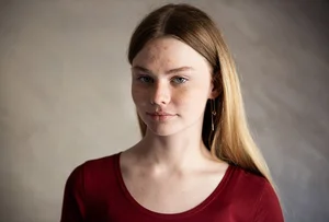 Helping Olesya: A 16-Year-Old's Fight Against Severe Scoliosis and the Need for Surgery - image 1