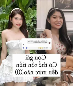 Esports MC Reveals Plastic Surgery Costs and Transformation Journey - image 4